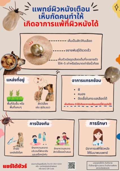 แพทย์ผิวหนังเตือนเห็บกัดคนทำให้เกิดอาการแพ้ที่ผิวหนังได้