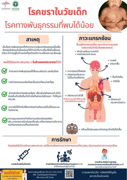 โรคชราในวัยเด็ก โรคทางพันธุกรรมที่พบได้น้อย