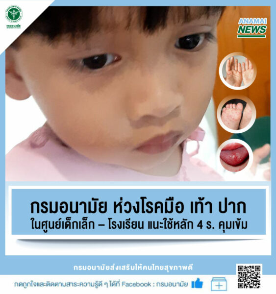 กรมอนามัย ห่วงโรคมือ เท้า ปาก ในศูนย์เด็กเล็ก – โรงเรียน แนะใช้หลัก 4 ร. คุมเข้ม