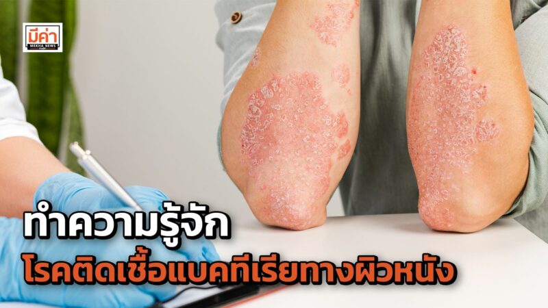 ทำความรู้จัก โรคติดเชื้อแบคทีเรียทางผิวหนัง
