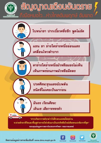 5 สัญญาณเตือนโรคหลอดเลือดสมอง