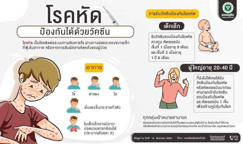 โรคหัด