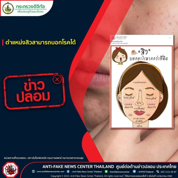 ตำแหน่งสิวสามารถบอกโรคได้จริงไหม