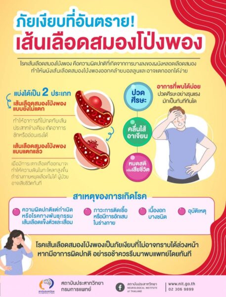 โรคเส้นเลือดสมองโป่งพอง Cerebral Aneurysm