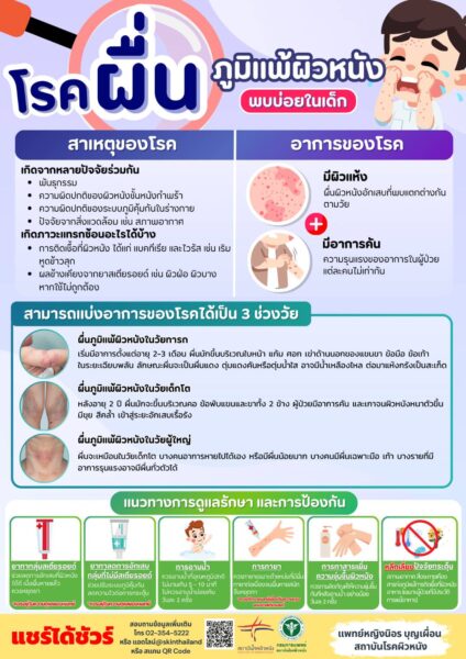How To รู้จักโรคผื่นภูมิแพ้ผิวหนังอักเสบ