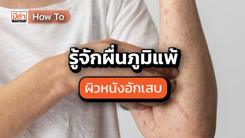 How To รู้จักโรคผื่นภูมิแพ้ผิวหนังอักเสบ