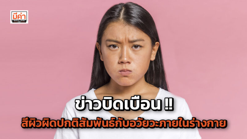 ข่าวบิดเบือน ก่อนเเชร์ต้องตรวจสอบความถูกต้อง เเละเเหล่งที่มาก่อน!!! สีผิวผิดปกติแต่ละสีจะสัมพันธ์กับอวัยวะภายในร่างกายที่ผิดปกติ