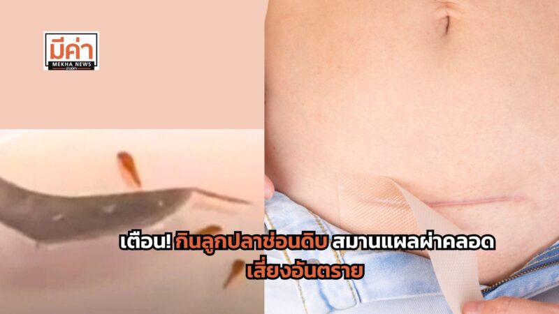เตือน! กินลูกปลาช่อนดิบ สมานแผลผ่าคลอด เสี่ยงอันตราย