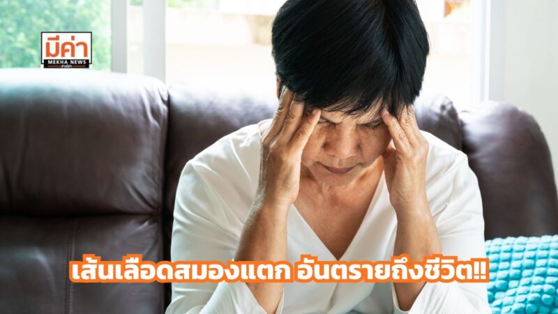 เลือดออกในสมอง จากเส้นเลือดสมองแตก ภาวะฉุกเฉินอันตรายถึงชีวิต!!